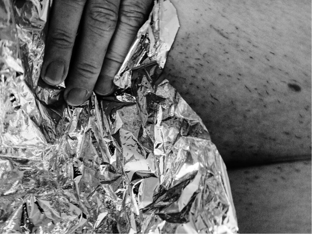 "Monochrome Bodies" series: anonymous body wrapped in a golden thermal blanket; black and white with gold as the only color.